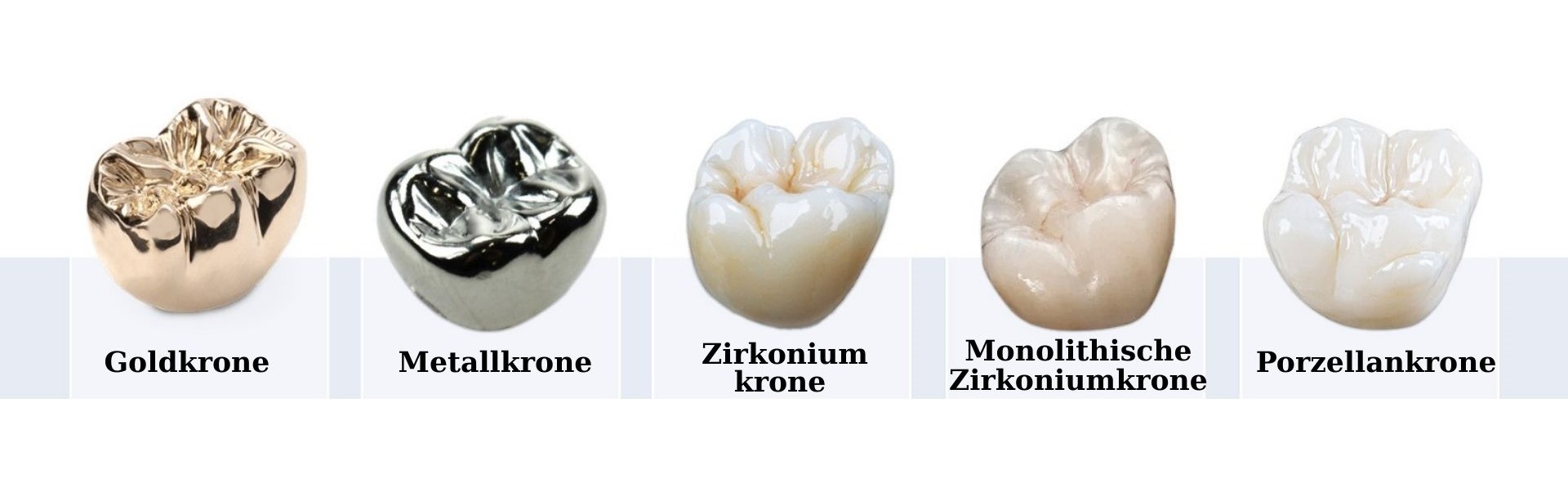 Welche Materialien werden bei All-on-4 & All-on-6 verwendet? 