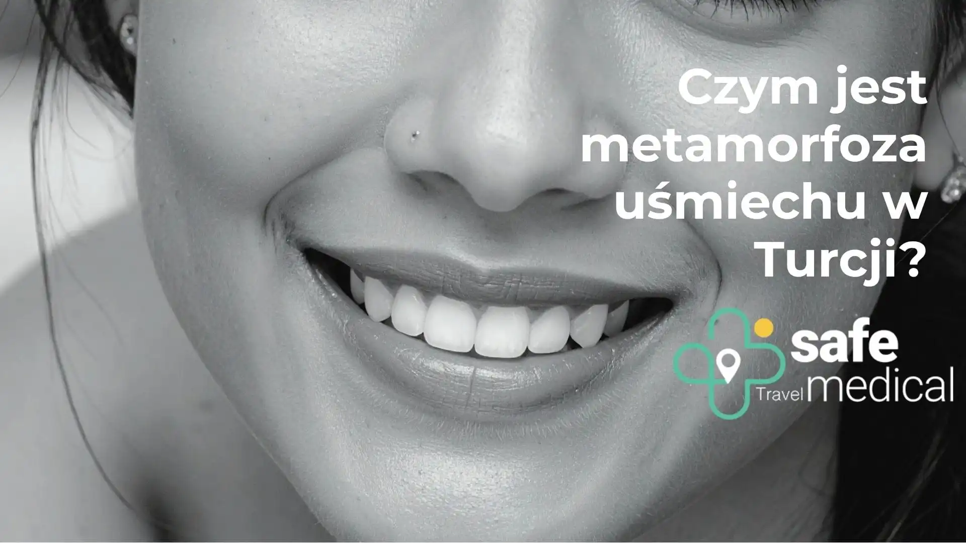 Czym jest Smile Makeover w Turcji?