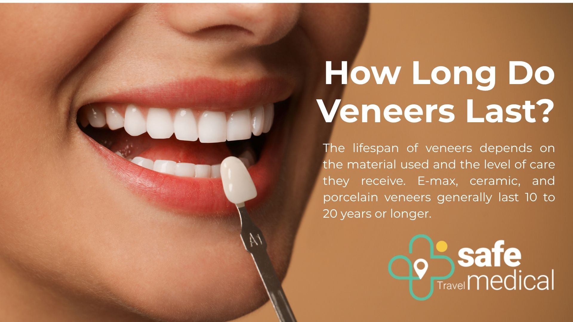 How long do veneers last in Turkey?