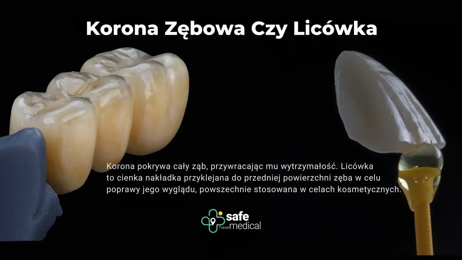 Korony i licówki dentystyczne w Turcji