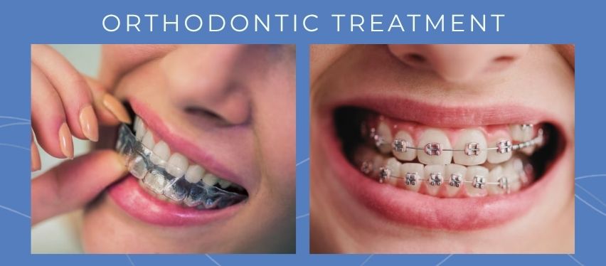orthodontic-treatment-turkey