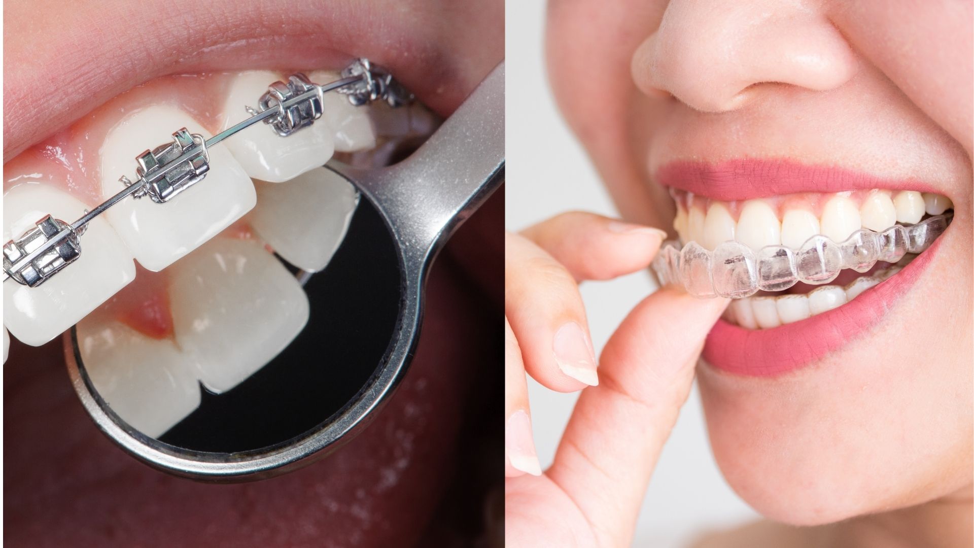 orthodontic-treatment orthodontic-treatment