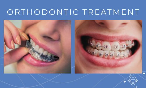 Discover The Best Orthodontic Treatment for Your Needs and Budget
