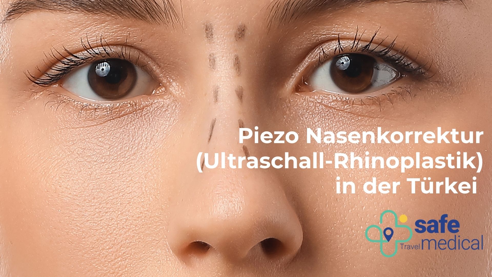 piezo-nasenkorrektur