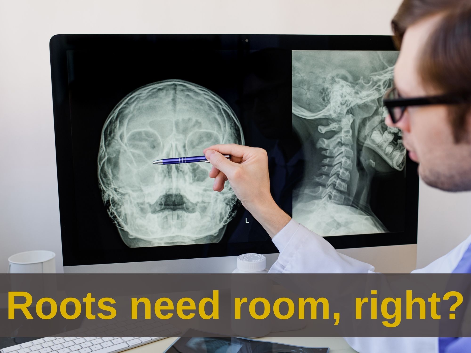 Why do we need Sinus Lift Surgery