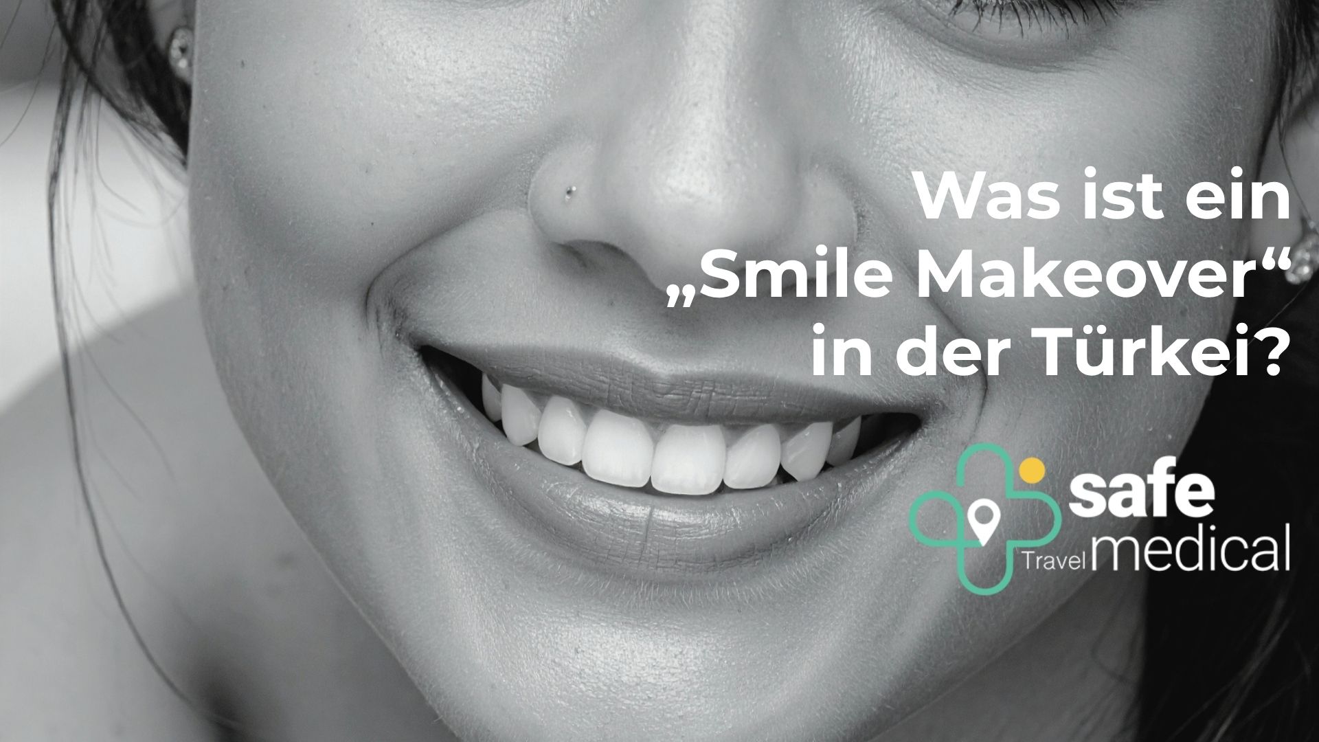 was-ist-ein-smile-makeover-in-der-turkei