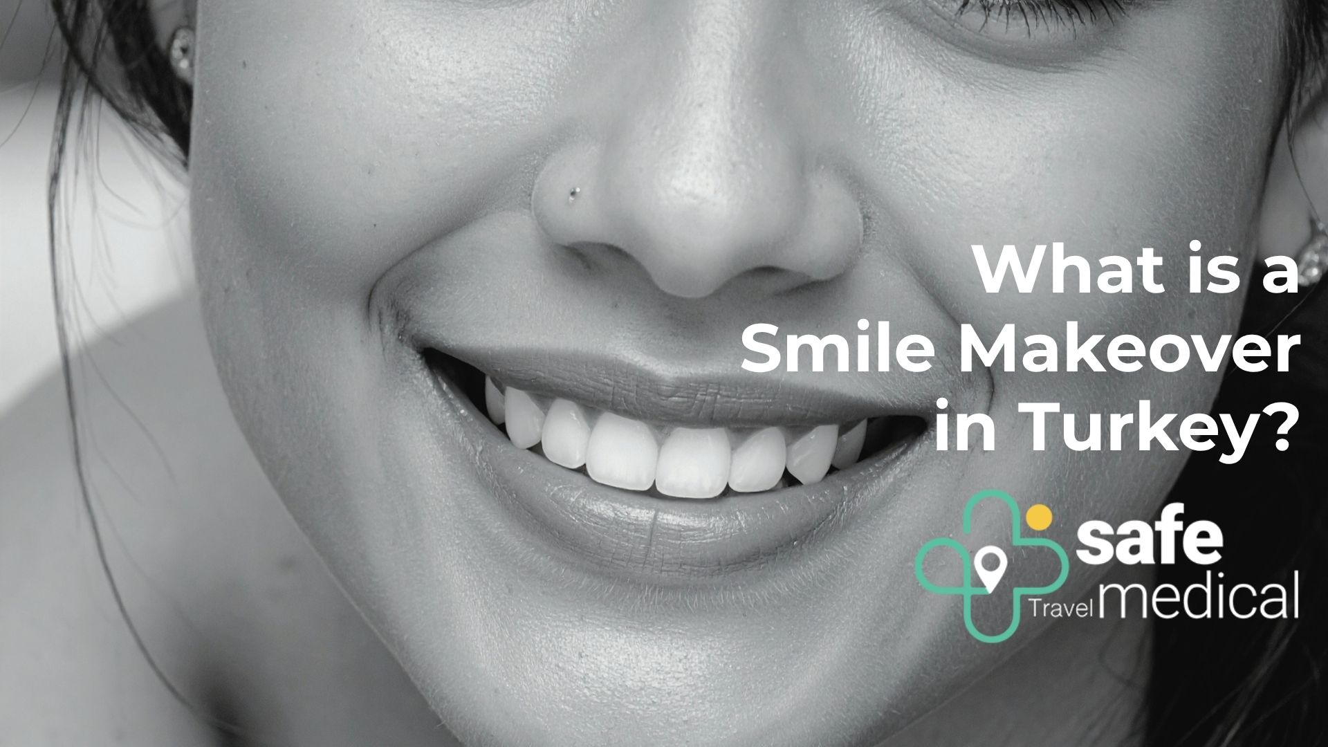 what-is-a-smile-makeover-in-turkey?