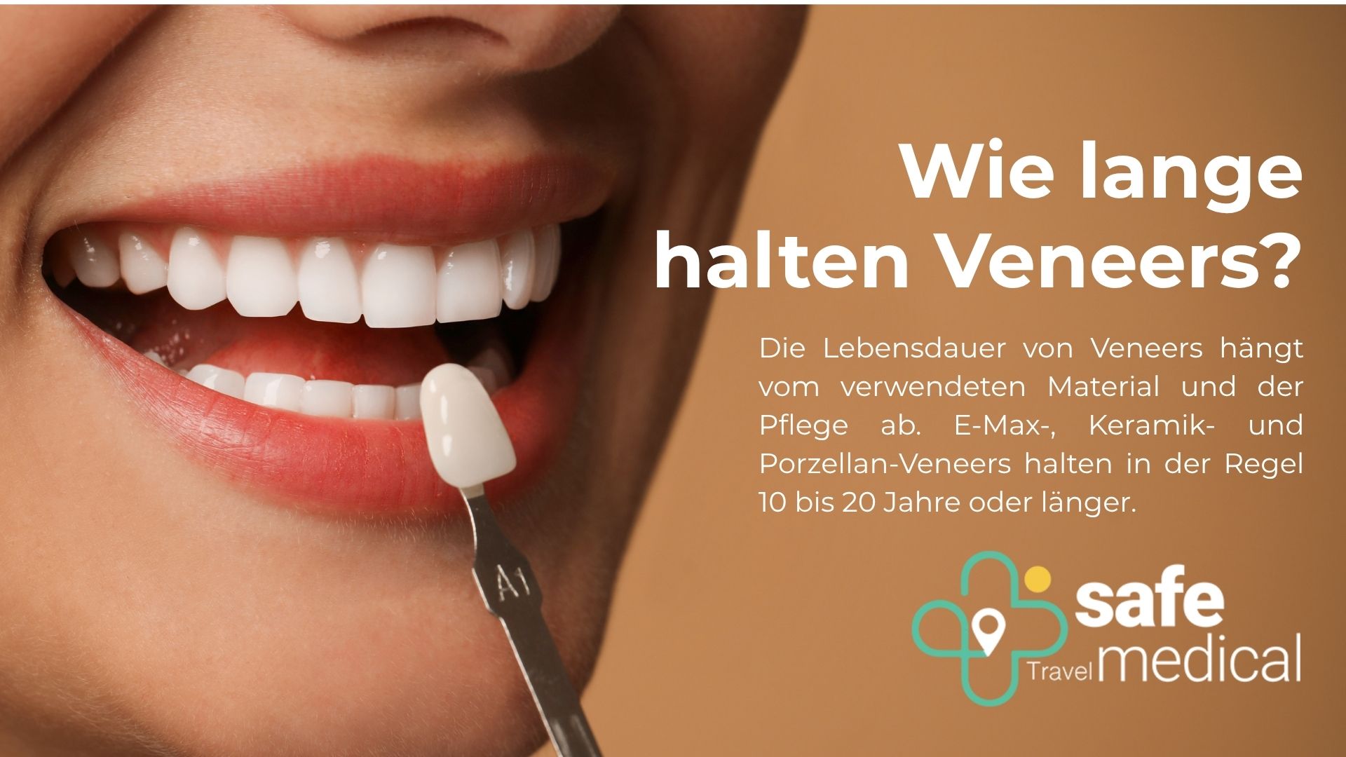 wie-lange-halten-veneers?
