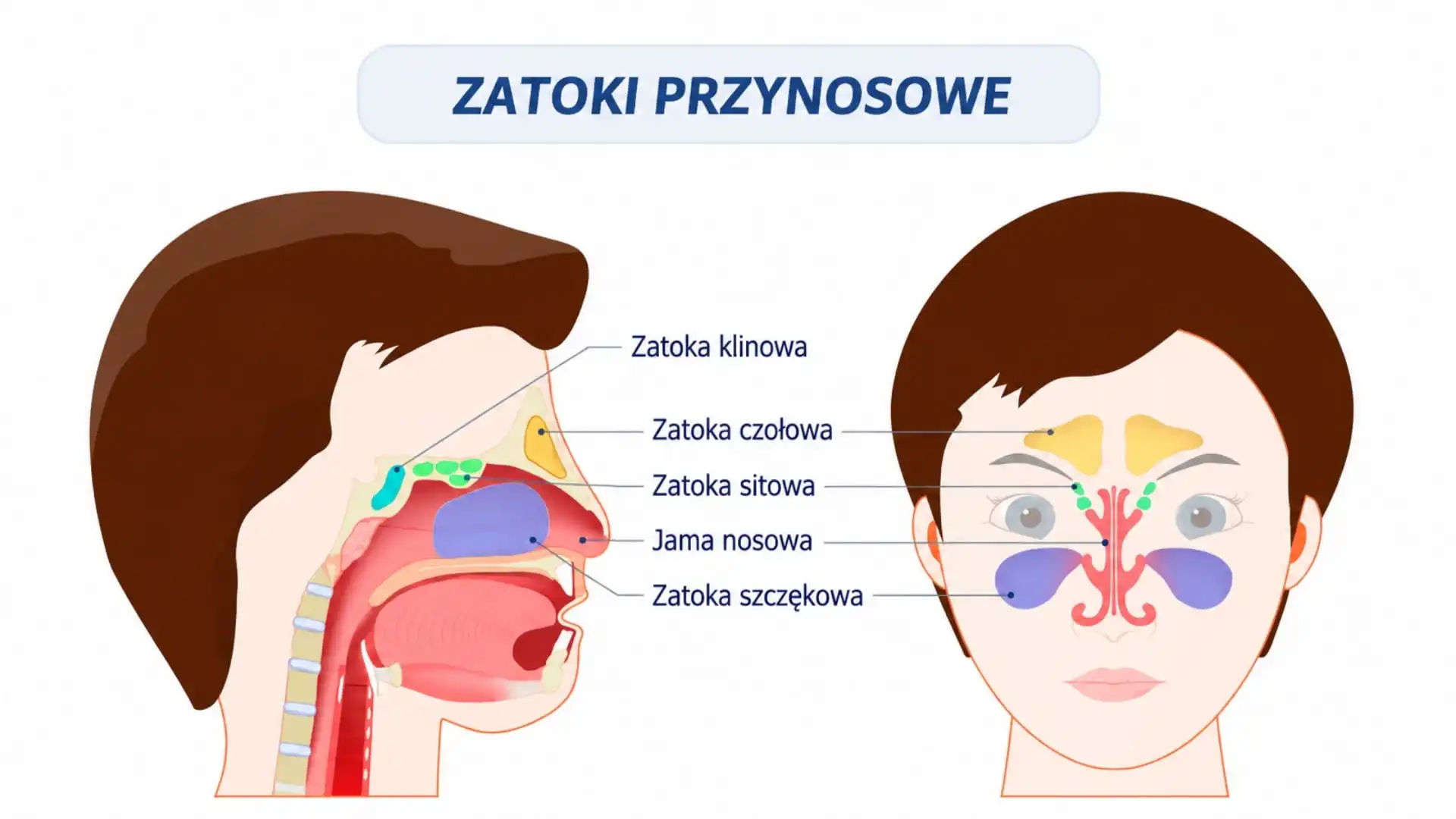 Znaczenie zatok szczękowych w planowaniu implantów zygomatycznych