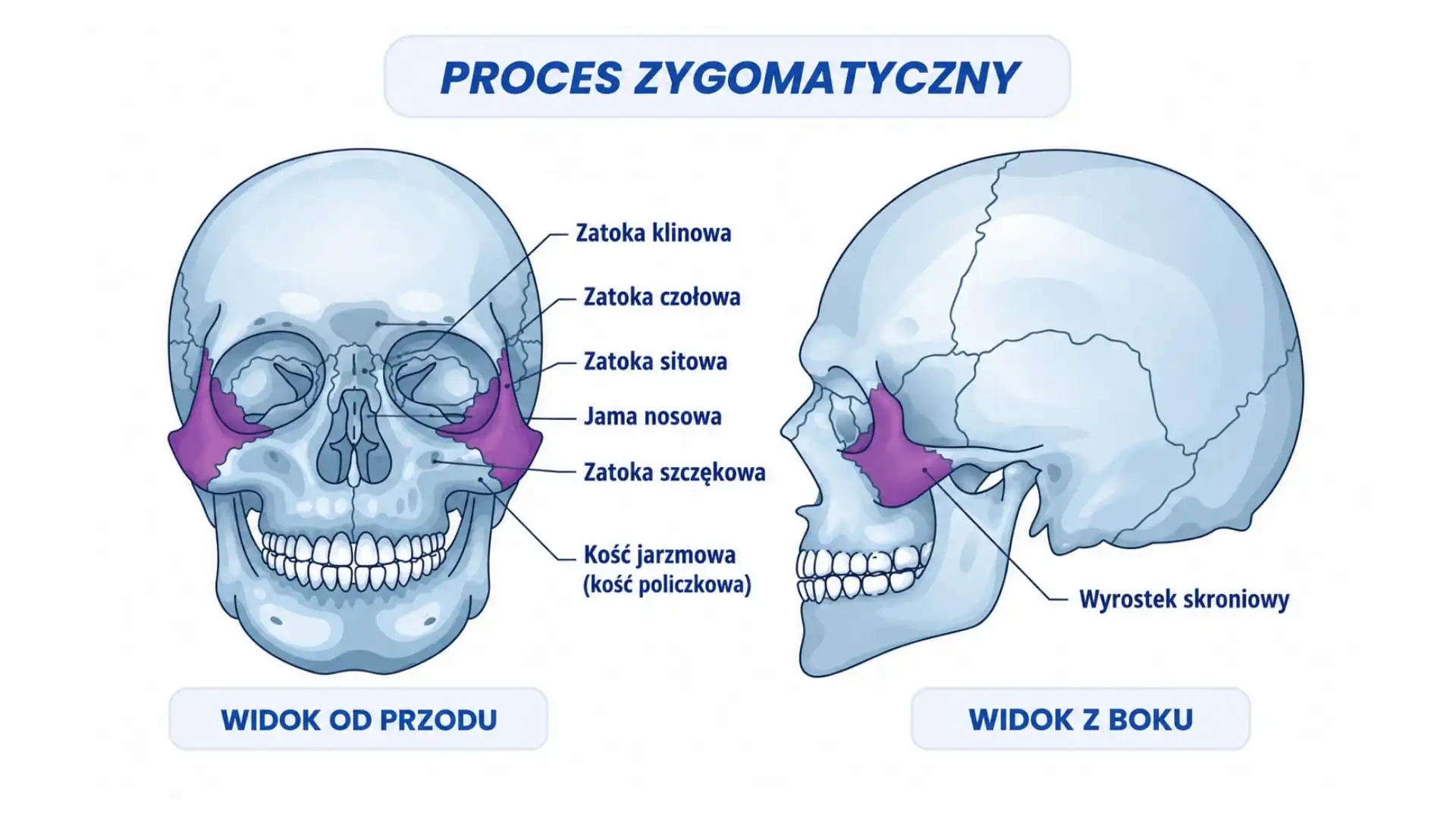 Planowanie i przebieg zabiegu wszczepienia implantów zygomatycznych